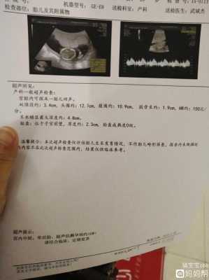 胎儿16周(孕16周宫缩怎么办,急) 第2张 胎儿16周(孕16周宫缩怎么办,急) 第2张