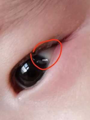 五个月胎儿(5个月宝宝眼睛眼屎多) 第3张 五个月胎儿(5个月宝宝眼睛眼屎多) 第3张