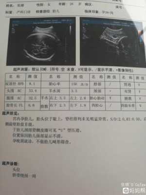 胎儿检测(胎儿检测时,所有遗传病都可以直接从羊水中) 第1张 胎儿检测(胎儿检测时,所有遗传病都可以直接从羊水中) 第1张
