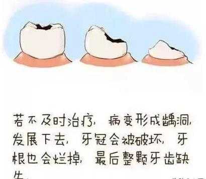 孕期牙齿松动(孕晚期一颗牙齿松动快要掉了有没有什么补救的方法) 第1张 孕期牙齿松动(孕晚期一颗牙齿松动快要掉了有没有什么补救的方法) 第1张