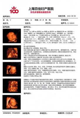 三维彩超结果怎么看,胎儿三维和四维有什么区别 第1张 三维彩超结果怎么看,胎儿三维和四维有什么区别 第1张