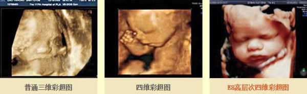 三维彩超结果怎么看,胎儿三维和四维有什么区别 第2张 三维彩超结果怎么看,胎儿三维和四维有什么区别 第2张