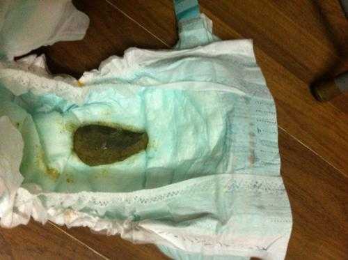 7个月胎儿(七个月小孩拉什么样屎正常) 第1张 7个月胎儿(七个月小孩拉什么样屎正常) 第1张