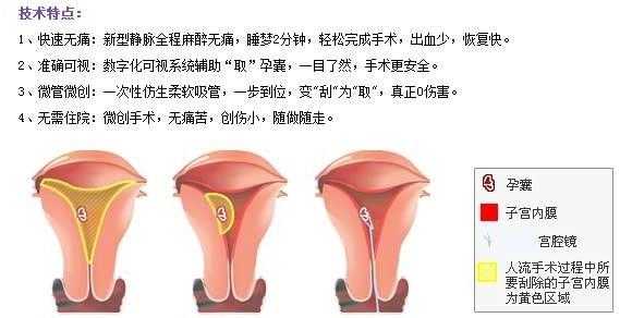 6周胎儿(怀孕6周该如何做人流) 第2张 6周胎儿(怀孕6周该如何做人流) 第2张