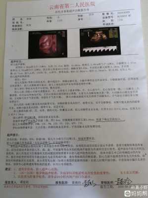 胎儿血管(胎儿血管走向异常严重吗) 第2张 胎儿血管(胎儿血管走向异常严重吗) 第2张