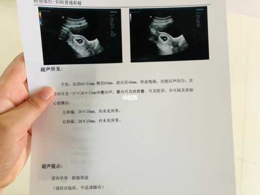 怀孕19周,每次给宝宝测胎心都在肚子左下方,正常吗,胎儿19周发育标准数值 第2张 怀孕19周,每次给宝宝测胎心都在肚子左下方,正常吗,胎儿19周发育标准数值 第2张
