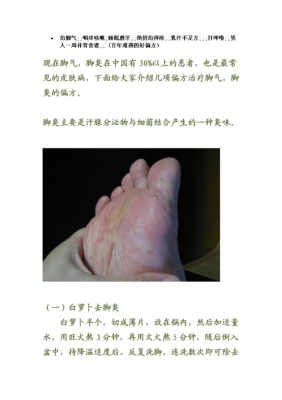 孕期脚气怎么办(孕期的脚气该怎样治疗) 第2张 孕期脚气怎么办(孕期的脚气该怎样治疗) 第2张