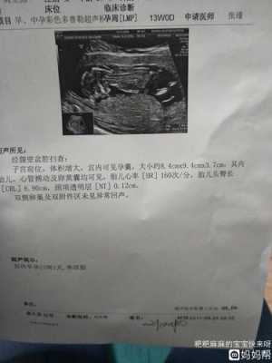 胎儿肠管扩张正常范围,四维彩超胎儿趴着不动怎么办 第2张 胎儿肠管扩张正常范围,四维彩超胎儿趴着不动怎么办 第2张