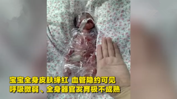 胎儿一个月（宝宝出生后一个月体重只增加了一斤，正常吗）  第3张