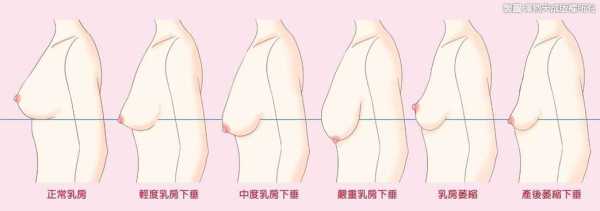 孕期乳头变大(孕期乳头变大了是什么情况) 第2张 孕期乳头变大(孕期乳头变大了是什么情况) 第2张