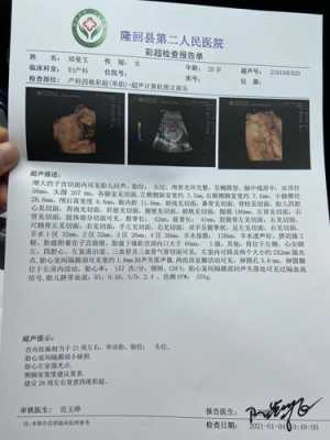 胎儿筛查(几个月的时候,才可以查出胎儿有没有畸形或者弱智) 第2张 胎儿筛查(几个月的时候,才可以查出胎儿有没有畸形或者弱智) 第2张