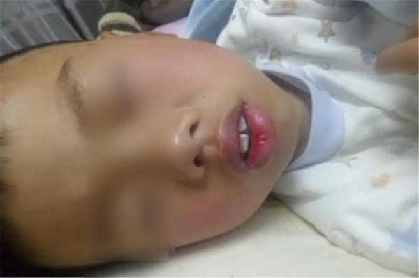 新生儿张嘴呼吸正常吗,原因是什么啊,胎儿呼吸靠什么 第3张 新生儿张嘴呼吸正常吗,原因是什么啊,胎儿呼吸靠什么 第3张