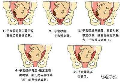 自然分娩胎儿从哪里出来,胎儿分娩的七个步骤示意图 第1张 自然分娩胎儿从哪里出来,胎儿分娩的七个步骤示意图 第1张