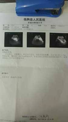 胎儿停止发育(胎儿停止发育) 第2张 胎儿停止发育(胎儿停止发育) 第2张