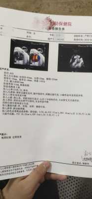 胎儿心脏有两个点是怎么回事,胎儿的心脏在几周发育完全 第2张 胎儿心脏有两个点是怎么回事,胎儿的心脏在几周发育完全 第2张