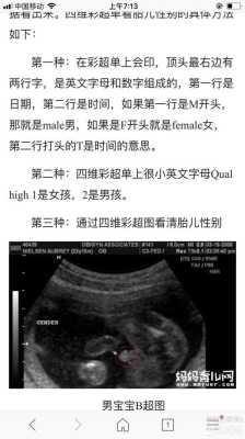 刚出生的婴儿怎么辨别男孩女孩,胎儿男女怎么看b超单 第2张 刚出生的婴儿怎么辨别男孩女孩,胎儿男女怎么看b超单 第2张