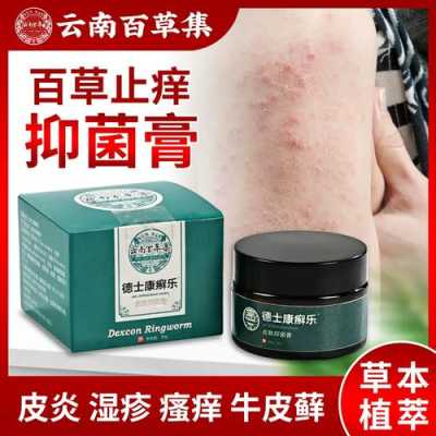 孕妇全身痒,可以用什么药,孕期浑身痒是什么原因 第2张 孕妇全身痒,可以用什么药,孕期浑身痒是什么原因 第2张
