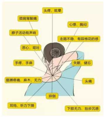 孕期颈椎病（孕期颈椎病）  第2张