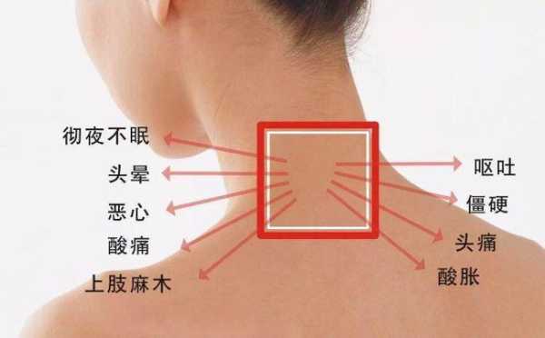 孕期颈椎病（孕期颈椎病）  第1张