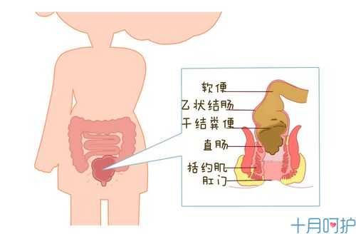 孕期便秘原因(孕期便秘原因有哪些) 第2张 孕期便秘原因(孕期便秘原因有哪些) 第2张