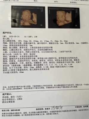 胎儿大排畸(大排畸多少周可以做) 第3张 胎儿大排畸(大排畸多少周可以做) 第3张