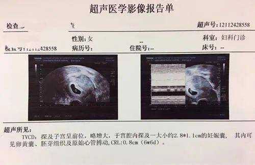 鉴定胎儿性别(鉴定胎儿性别) 第3张 鉴定胎儿性别(鉴定胎儿性别) 第3张
