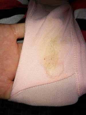 孕期乳头黑(孕妇乳头变黑正常吗) 第2张 孕期乳头黑(孕妇乳头变黑正常吗) 第2张
