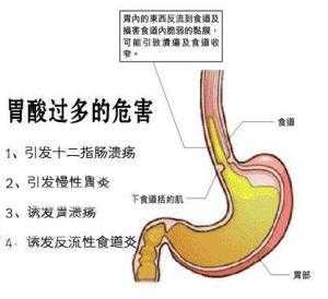 孕期胃酸过多(孕期胃酸过多是什么原因造成的) 第1张 孕期胃酸过多(孕期胃酸过多是什么原因造成的) 第1张