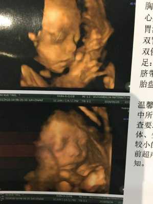 四维胎儿图片(孩子四维报喜朋友圈) 第2张 四维胎儿图片(孩子四维报喜朋友圈) 第2张