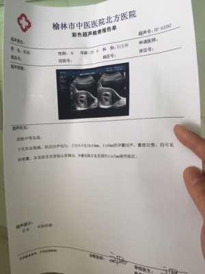 胎儿左侧侧脑室(胎儿一侧侧脑室见宽约0,6cm液性暗区意味着什么) 第1张 胎儿左侧侧脑室(胎儿一侧侧脑室见宽约0,6cm液性暗区意味着什么) 第1张
