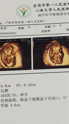 宝宝有点盘舌子有影响吗,胎儿盘腿坐着是男孩还是女孩  第3张