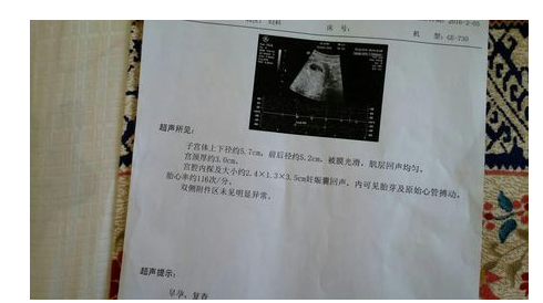 胎儿没有胎心(胎儿没胎心是什么原因,是什么原因导致的呢) 第2张 胎儿没有胎心(胎儿没胎心是什么原因,是什么原因导致的呢) 第2张