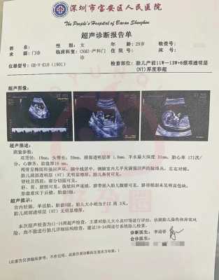 孕妇可以憋尿吗,胎儿憋尿B超会出现什么结果 第1张 孕妇可以憋尿吗,胎儿憋尿B超会出现什么结果 第1张