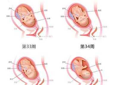 孕胎儿偏大(孕胎儿偏大一周怎么办?这是什么情况) 第3张 孕胎儿偏大(孕胎儿偏大一周怎么办?这是什么情况) 第3张