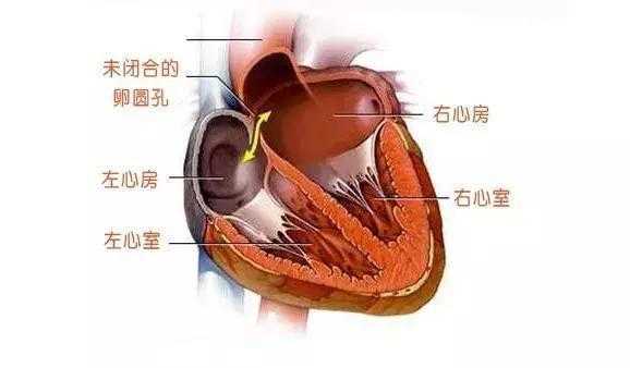 胎儿卵圆孔(卵圆孔是什么) 第2张 胎儿卵圆孔(卵圆孔是什么) 第2张
