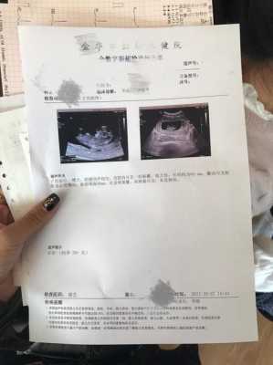 11周+孕期检查NT值3.4，是不是说明胎儿不正常,孕11周胎儿大小  第2张