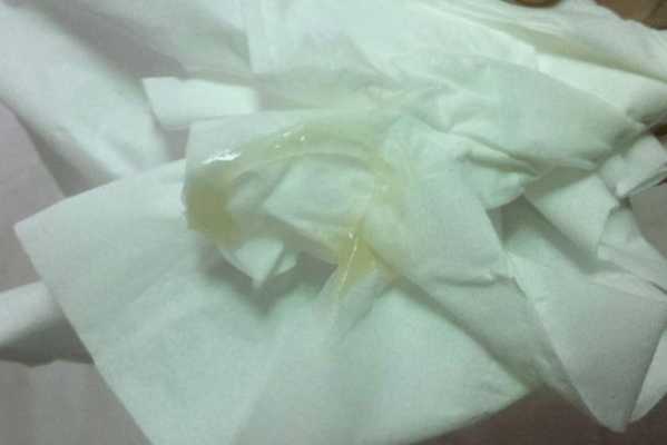 孕期分泌物黄绿色(孕期分泌物黄绿色不痒无异味) 第1张 孕期分泌物黄绿色(孕期分泌物黄绿色不痒无异味) 第1张