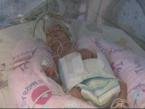 怀孕六个月胎儿(怀孕六个月胎儿体重多少正常) 第2张 怀孕六个月胎儿(怀孕六个月胎儿体重多少正常) 第2张
