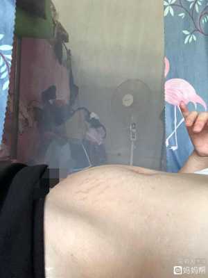 孕15周胎儿(怀孕15周了,感觉肚子总是胀胀的是怎么回事呢) 第2张 孕15周胎儿(怀孕15周了,感觉肚子总是胀胀的是怎么回事呢) 第2张