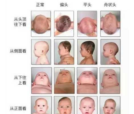 胎儿头型(婴儿剪什么头型好) 第3张 胎儿头型(婴儿剪什么头型好) 第3张