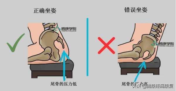 孕期尾巴骨疼(孕期尾巴骨疼怎么回事) 第1张 孕期尾巴骨疼(孕期尾巴骨疼怎么回事) 第1张