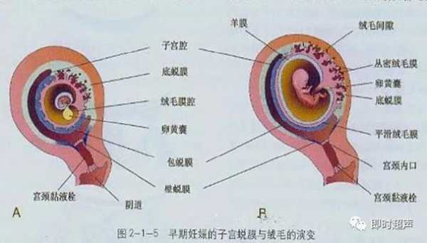 绒毛膜下出血是怎么回事,胎儿绒毛检查能检查出什么 第2张 绒毛膜下出血是怎么回事,胎儿绒毛检查能检查出什么 第2张