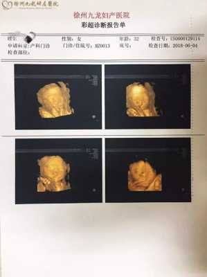 胎儿彩超图片(胎儿彩超检查什么) 第2张 胎儿彩超图片(胎儿彩超检查什么) 第2张