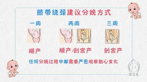 孕30周胎儿颈部脐带绕颈两周,平时需要注意哪些,胎儿绕颈两周能顺产吗? 第2张 孕30周胎儿颈部脐带绕颈两周,平时需要注意哪些,胎儿绕颈两周能顺产吗? 第2张