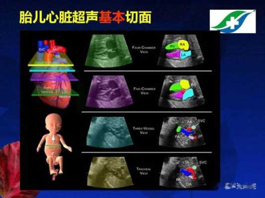 胎儿心动图(胎儿心动图主要检查什么) 第2张 胎儿心动图(胎儿心动图主要检查什么) 第2张