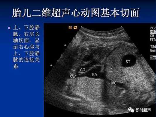 胎儿心动图(胎儿心动图主要检查什么) 第1张 胎儿心动图(胎儿心动图主要检查什么) 第1张