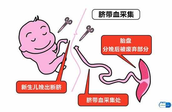胎儿脐带血(储存脐带血生孩子是什么情况?有什么作用啊) 第3张 胎儿脐带血(储存脐带血生孩子是什么情况?有什么作用啊) 第3张