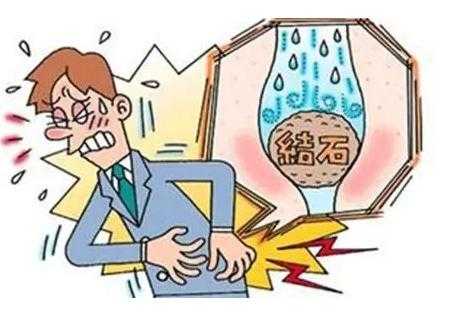 孕期肾结石怎么办(孕期肾结石痛怎么办) 第2张 孕期肾结石怎么办(孕期肾结石痛怎么办) 第2张