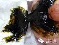胎儿胎粪(胎儿胎粪怎么排出) 第1张 胎儿胎粪(胎儿胎粪怎么排出) 第1张