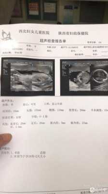 胎儿nf(有懂孕期NF增厚的大神吗) 第2张 胎儿nf(有懂孕期NF增厚的大神吗) 第2张